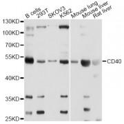 Western blot analysis of extracts of various cell lines, using CD40 Antibody (abx000604) at 1/1000 dilution.
