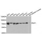 Western blot analysis of extracts of various cell lines, using RAF1 antibody (abx000608) at 1/1000 dilution.