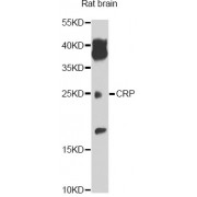 Western blot analysis of extracts of rat brain, using CRP antibody (abx000609) at 1/1000 dilution.