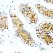Immunohistochemistry of paraffin-embedded human stomach using SIRT1 antibody (abx000615) at dilution of 1/100 (40x lens).