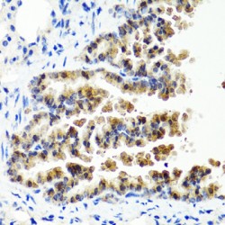 Sirtuin 1 (SIRT1) Antibody
