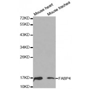 Western blot analysis of extracts of various cell lines, using FABP4 antibody (abx000617) at 1/1000 dilution.