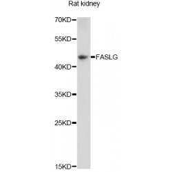 Tumor Necrosis Factor Ligand Superfamily Member 6 (FasLG) Antibody