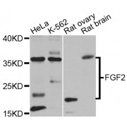 Western blot analysis of extracts of various cell lines, using FGF2 antibody (abx000620) at 1/1000 dilution.