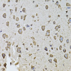 Fibroblast Growth Factor 2 (FGF2) Antibody