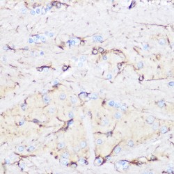 Glial Fibrillary Acidic Protein (GFAP) Antibody