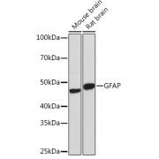 Western blot analysis of extracts of various cell lines, using GFAP antibody (1/1000 dilution).