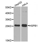 Western blot analysis of extracts of various cell lines, using HSPB1 antibody (abx000625) at 1/1000 dilution.