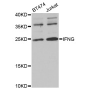 Western blot analysis of extracts of various cell lines, using IFNG antibody (abx000627) at 1/1000 dilution.