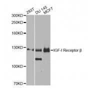 Western blot analysis of extracts of various cell lines, using IGF1R antibody (abx000628) at 1/1000 dilution.