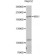 Western blot analysis of extracts of HepG2 cells, using IRS1 antibody (abx000630) at 1/1000 dilution.