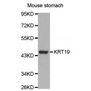 Western blot analysis of extracts of mouse stomach, using KRT19 antibody (abx000632) at 1/1000 dilution.