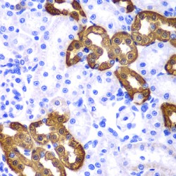 Keratin 19 (KRT19) Antibody