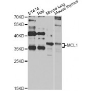 Western blot analysis of extracts of various cell lines, using MCL1 antibody (abx000635) at 1/1000 dilution.