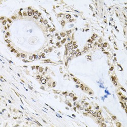 Induced Myeloid Leukemia Cell Differentiation Protein (MCL1) Antibody