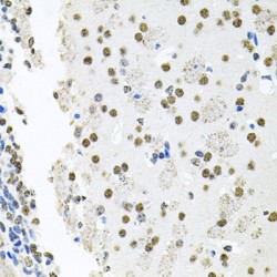 Induced Myeloid Leukemia Cell Differentiation Protein (MCL1) Antibody