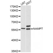 Western blot analysis of extracts of various cell lines, using NAMPT antibody (abx000641) at 1/1000 dilution.