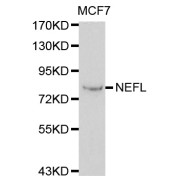 Western blot analysis of extracts of MCF-7 cells, using NEFL antibody (abx000642) at 1/1000 dilution.