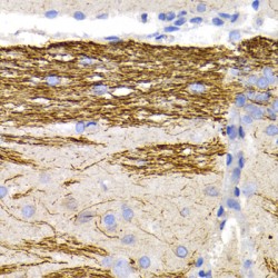 Neurofilament, Light Polypeptide (NEFL) Antibody