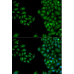 Neurofilament, Light Polypeptide (NEFL) Antibody