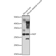 Western blot analysis of extracts of various cell lines, using NGF antibody (1/1000 dilution).