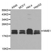 Western blot analysis of extracts of various cell lines, using NME1 antibody (abx000644) at 1/1000 dilution.