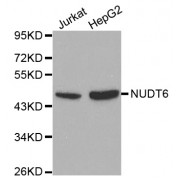 Western blot analysis of extracts of various cell lines, using NUDT6 antibody (abx000645) at 1/1000 dilution.