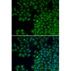 Antisense Basic Fibroblast Growth Factor (NUDT6) Antibody
