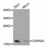 Western blot analysis of extracts of various cell lines, using CDKN2A antibody (abx000647).
