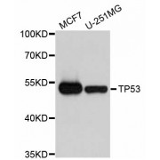 Western blot analysis of extracts of various cell lines, using TP53 antibody (abx000648) at 1/1000 dilution.