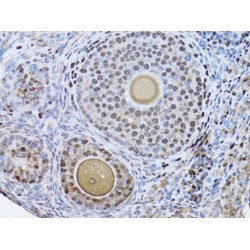 Proliferating Cell Nuclear Antigen (PCNA) Antibody