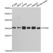 Western blot analysis of extracts of various cell lines, using PCNA antibody (abx000649) at 1/1000 dilution.
