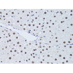 Proliferating Cell Nuclear Antigen (PCNA) Antibody