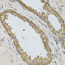 Phosphatidylinositol-4,5-Bisphosphate 3-Kinase Catalytic Subunit Alpha Isoform (PIK3CA) Antibody