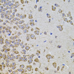 Phosphatidylinositol-4,5-Bisphosphate 3-Kinase Catalytic Subunit Alpha Isoform (PIK3CA) Antibody