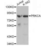 Western blot analysis of extracts of various cell lines, using PRKCA antibody (abx000652).