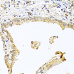 Protein Kinase C Alpha (PRKCA) Antibody