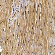 Immunohistochemistry analysis of paraffin-embedded Mouse heart tissue using PPARG Antibody (1/200 dilution, 40x magnification). Antigen retrieval was performed under high pressure using 10 mM Citrate, pH 6.0.