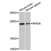Western blot analysis of extracts of various cell lines, using RhoA antibody (abx000657) at 1/1000 dilution.