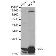 Western blot analysis of extracts of various cell lines, using SOD1 antibody (abx000659) at 1/1000 dilution.