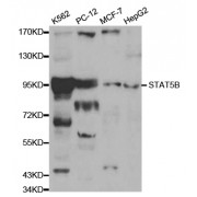 Western blot analysis of extracts of various cell lines, using STAT5B antibody (abx000660) at 1/1000 dilution.
