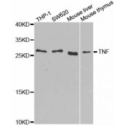 Western blot analysis of extracts of various cell lines, using TNF antibody (abx000662) at 1/1000 dilution.