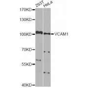 Western blot analysis of extracts of various cell lines, using VCAM1 Antibody (abx000664) at 1/1000 dilution.