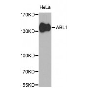 Western blot analysis of extracts of HeLa cells, using ABL1 antibody (abx000665) at 1/1000 dilution.