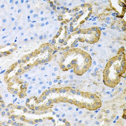 Tyrosine-Protein Kinase ABL1 (ABL1) Antibody