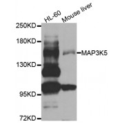 Western blot analysis of extracts of various cell lines, using MAP3K5 antibody (abx000666) at 1/1000 dilution.