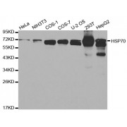 Western blot analysis of extracts of various cell lines, using HSPA1A antibody (abx000667) at 1/1000 dilution.