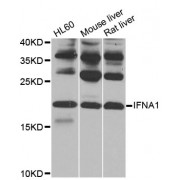 Western blot analysis of extracts of various cell lines, using IFNA1 antibody (abx000668) at 1/1000 dilution.