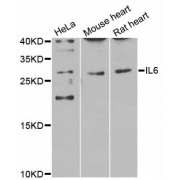 Western blot analysis of extracts of various cell lines, using IL6 antibody (abx000669) at 1/1000 dilution.
