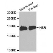 Western blot analysis of extracts of various cell lines, using INSR antibody (abx000670) at 1/1000 dilution.